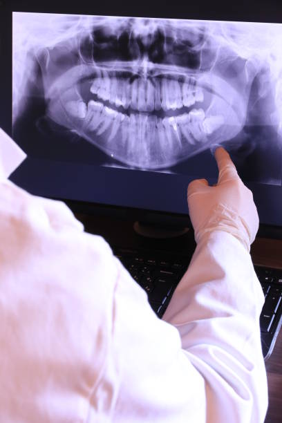 Best Emergency Dental Surgery in Vineyard, CA